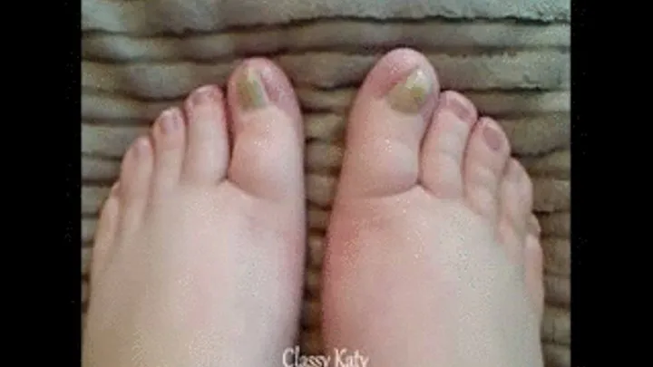 Hear about my ugly toenails!