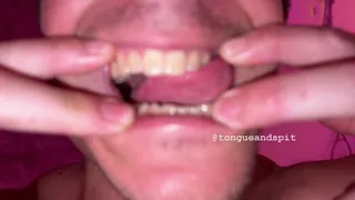 Logan Teeth Part17 Video1