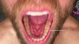 Andrew Teeth Bottom Molars and Retainer Part17 Video1