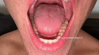 Andrew Mouth and Lower Teeth Part16 Video1