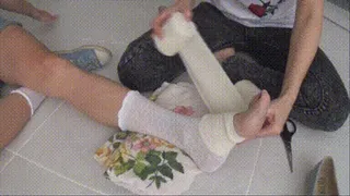 My broken leg and masturbation with bandaging Ja