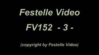 FV152-3: 3. Part