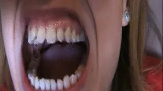 Chompers