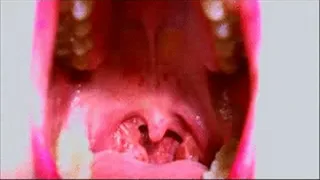 View Inside My Mouth