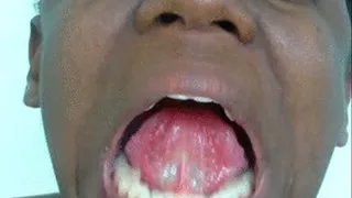 Tongue Veins