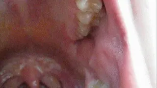 PLAYFUL UVULA 640* 0:20:33