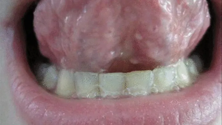 CRAZY UVULA