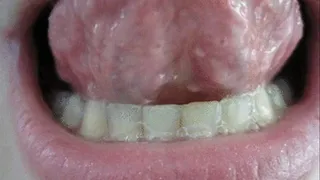 CRAZY UVULA