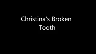 Christina's Broken tooth