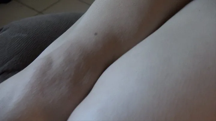 Leg Bumps