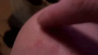 Blister Popping II