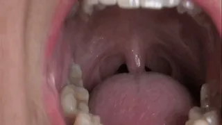 Dirty teeth brushing close