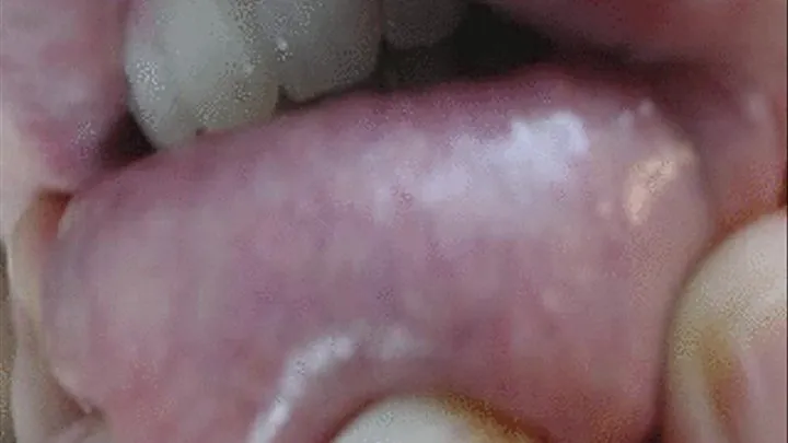 Lip Veins