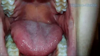 Mouth, Dirty Teeth, and Tongue Show Off