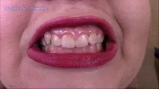 Showing off Stained Teeth