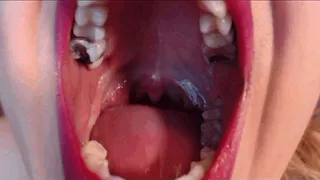 MAKING MY UVULA DANCE (Oct.2017)