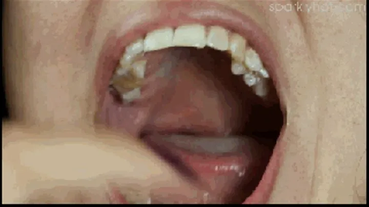 Close up of my mouth