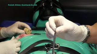 Double Rubber Nurse Treatments