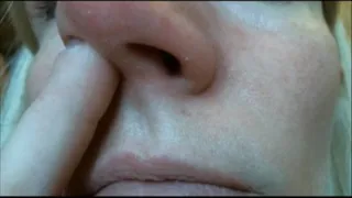 Nose picking and pinching (nose fetish)