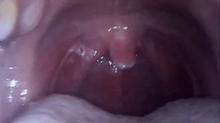 Tonsilitis (uvula fetish)