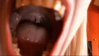 Explore my mouth (gag reflex)