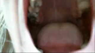 Take a look inside of my mouth