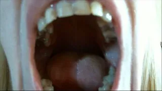 Garlic breath (mouth fetish)