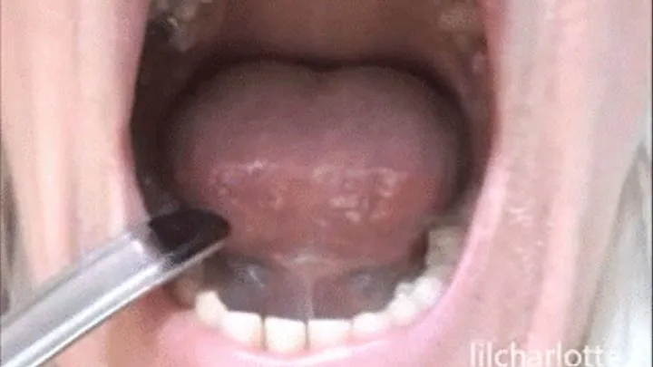 Deep inside my mouth