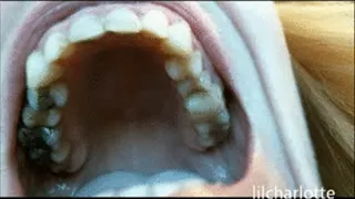 Exploring inner mouth 4