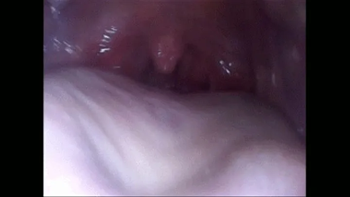 Sore throatand tonsilitis (uvula fetish)