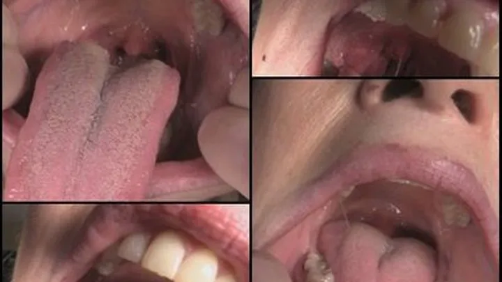 A Nasty Mouth