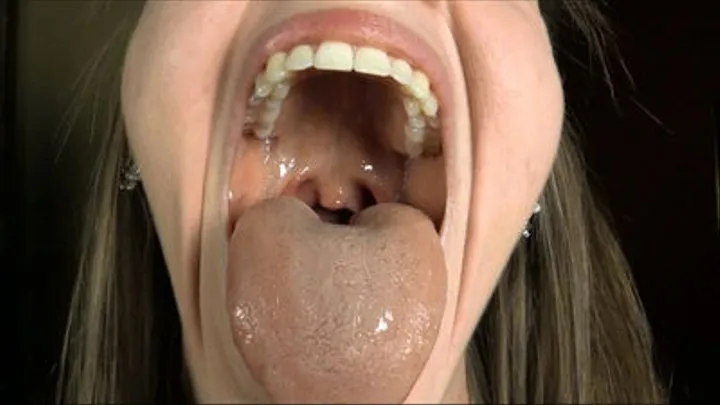 OMG Thats My Uvula