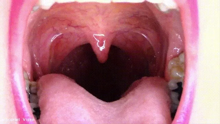 Uvula Flexing & Vibrating