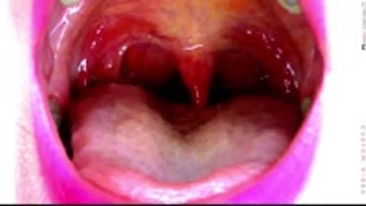 Showing Off My Uvula, Open Up and Say AHH!