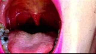 Showing Off My Uvula, Open Up and Say AHH!