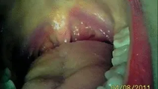 RAW endoscopic Tour of my Mouth