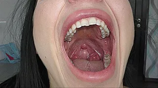 swallow air and yawn