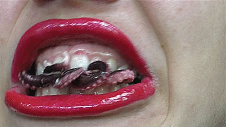 details of the whole mouth