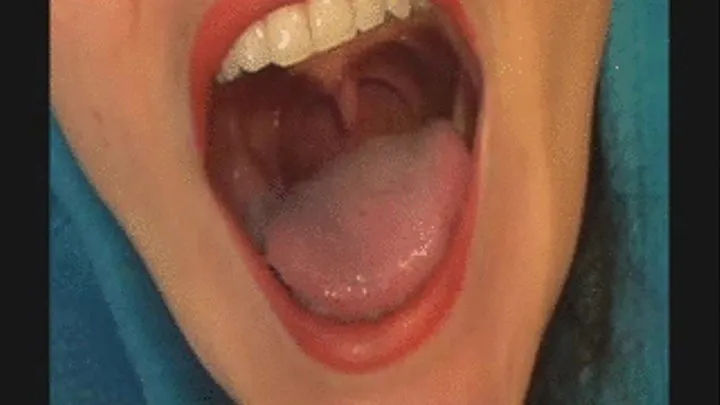 Uvula Dance