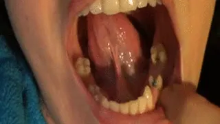 Teeth Lips and Tongue