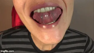 Deep Tongue Veins and Bumps