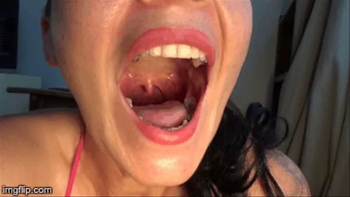 Uvula Close Up