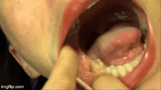 Teeth and Gums with Lip Stretching