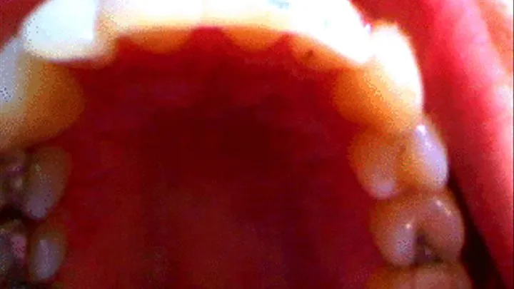 Sarah's Sexy Teeth, Up Close and Personal