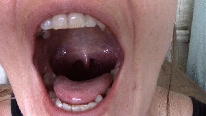 Sarah's Uvula Dangle