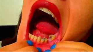 (Request) Sarah pulls on her lips to show off her teeth