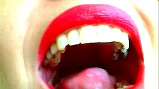 uvula hiccups