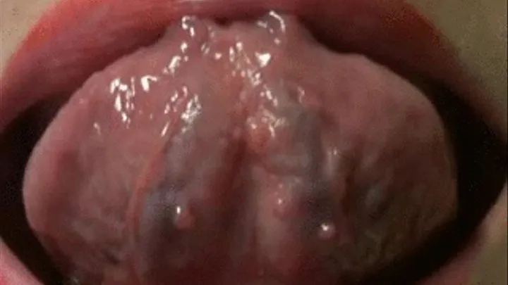 Tongue Veins