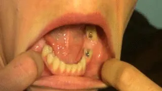 Mouth Stretched Open