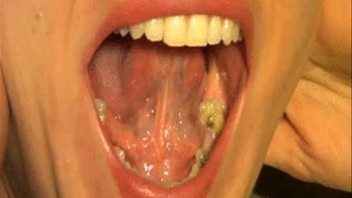 Mouth Stretched Open